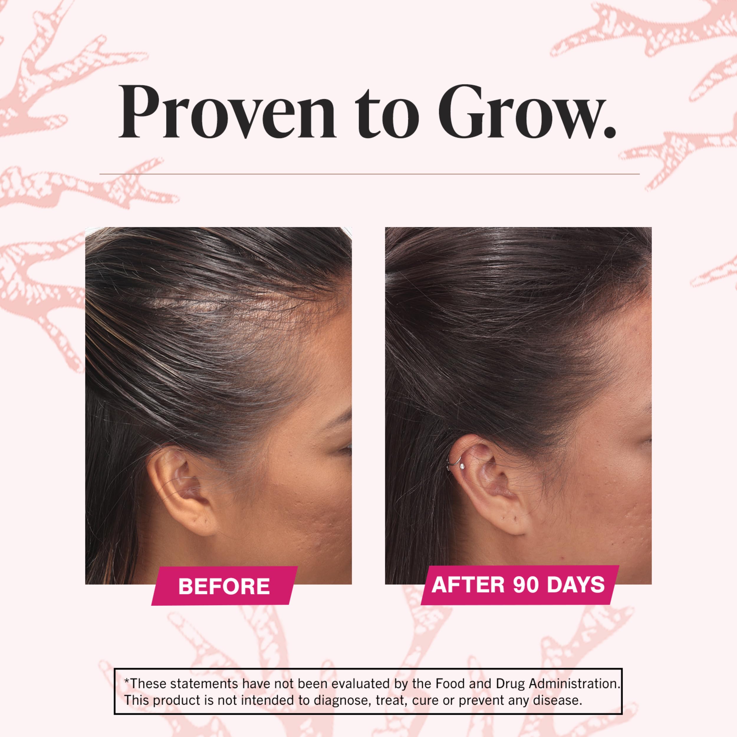 Viviscal Hair Growth Supplements For Women For Thicker, Fuller Hair, Nourishes Thinning & Loss, With Proprietary Collagen Complex, 180 Tablets, 3 Month Supply