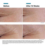 Before and after comparison of skin treatment results on a white background